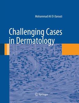 Paperback Challenging Cases in Dermatology Book