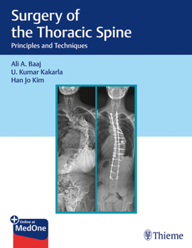Hardcover Surgery of the Thoracic Spine: Principles and Techniques Book