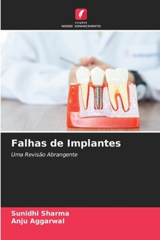 Paperback Falhas de Implantes [Portuguese] Book