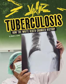 Hardcover Tuberculosis: How the White Death Changed History Book