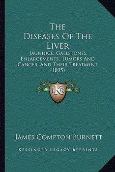 Paperback The Diseases Of The Liver: Jaundice, Gallstones, Enlargements, Tumors And Cancer, And Their Treatment (1895) Book