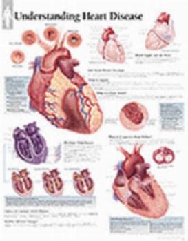 Paperback Understanding Heart Disease Chart: Wall Chart Book