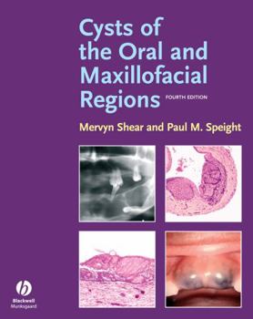 Hardcover Cysts of the Oral and Maxillofacial Regions Book