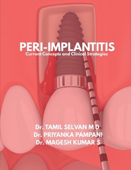 Peri-Implantitis: Current Concepts and Clinical Strategies