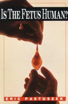 Paperback Is the Fetus Human? Book