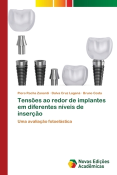 Paperback Tensões ao redor de implantes em diferentes níveis de inserção [Portuguese] Book