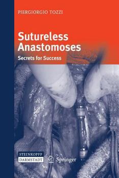 Paperback Sutureless Anastomoses: Secrets for Success Book