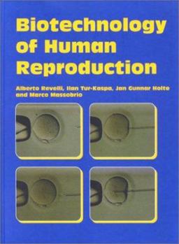 Paperback Biotechnology Of Human Reproduction Book