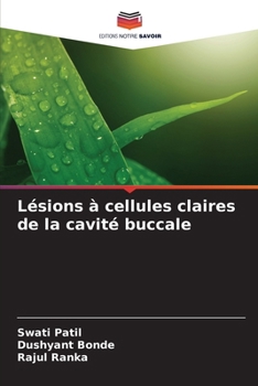 Paperback Lésions à cellules claires de la cavité buccale [French] Book