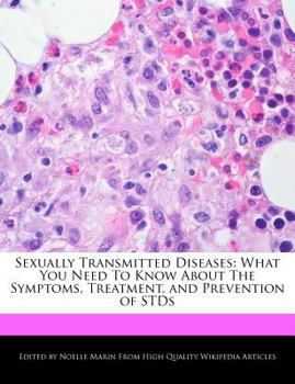 Sexually Transmitted Diseases : What You Need to Know about the Symptoms, Treatment, and Prevention of STDs