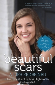 Paperback Beautiful Scars: A Life Redefined Book