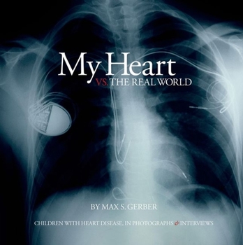 Hardcover My Heart vs. the Real World: Children with Heart Disease, in Photographs and Interviews Book