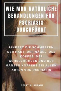 Paperback Wie Man Natürliche Behandlungen Für Psoriasis Durchführt: Lindert Die Schmerzen Der Haut, Der Nägel, Des Kopfes, Der Achselhöhlen Und Des Ganzen Körpe [German] Book