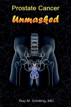 Paperback Prostate Cancer Unmasked Book