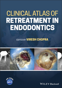 Hardcover Clinical Atlas of Retreatment in Endodontics Book