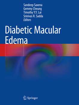 Paperback Diabetic Macular Edema Book