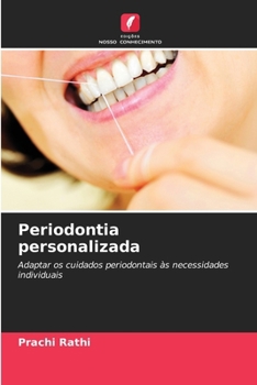 Periodontia personalizada (Portuguese Edition)