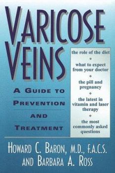 Paperback Varicose Veins: A Guide to Prevention and Treatment Book