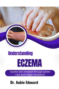 Paperback Understanding Eczema: Soothe skin irritation through gentle care and trigger avoidance Book