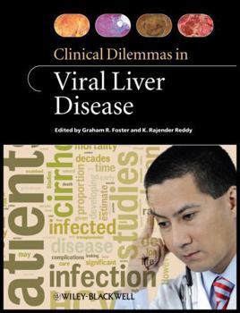 Paperback Clinical Dilemmas in Viral Liver Disease Book