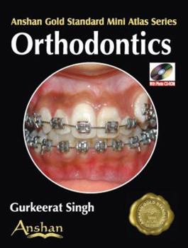 Paperback Mini Atlas of Orthodontics Book