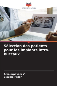 Paperback Sélection des patients pour les implants intra-buccaux [French] Book