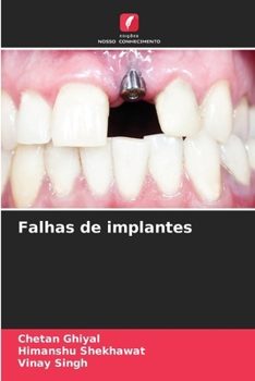 Paperback Falhas de implantes [Portuguese] Book