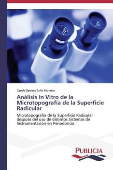 Paperback Análisis In Vitro de la Microtopografía de la Superficie Radicular [Spanish] Book