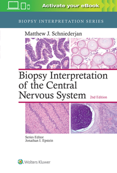Hardcover Biopsy Interpretation of the Central Nervous System Book