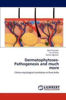 Paperback Dermatophytoses-Pathogenesis and much more Book