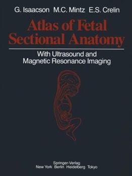 Paperback Atlas of Fetal Sectional Anatomy: With Ultrasound and Magnetic Resonance Imaging Book