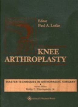 Hardcover Knee Arthroplasty Book