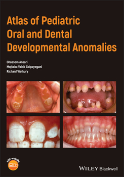 Paperback Atlas of Pediatric Oral and Dental Developmental Anomalies Book