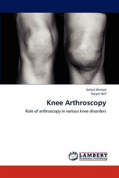 Knee Arthroscopy: Role of arthroscopy in various knee disorders