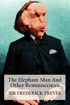 Paperback The Elephant Man and Other Reminiscences Book