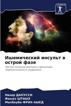 Paperback Ишемический инсульт в ос [Russian] Book