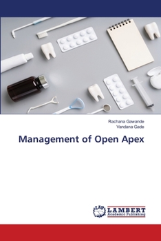 Paperback Management of Open Apex Book