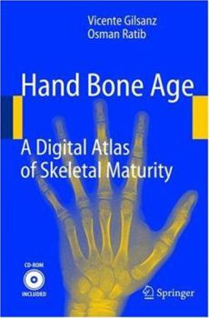 Paperback Hand Bone Age: A Digital Atlas of Skeletal Maturity Book