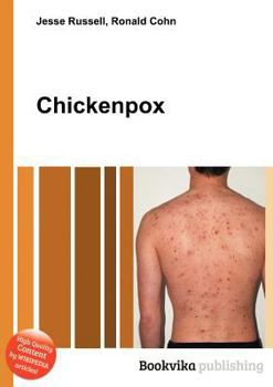 Paperback Chickenpox Book