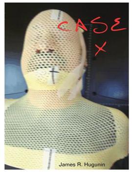 Hardcover Case X Book