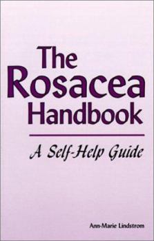 Paperback The Rosacea Handbook: A Self-Help Guide Book