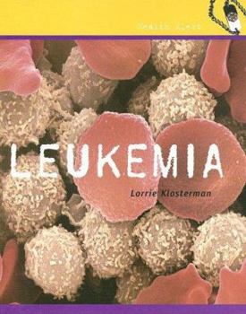 Library Binding Leukemia Book