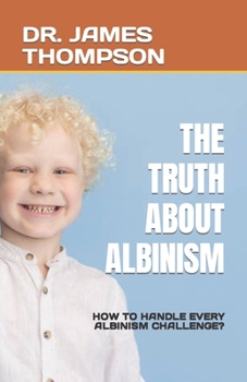 Paperback The Truth about Albinism: How to Handle Every Albinism Challenge? Book