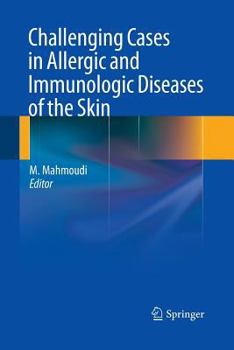 Paperback Challenging Cases in Allergic and Immunologic Diseases of the Skin Book