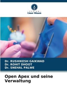 Paperback Open Apex und seine Verwaltung [German] Book