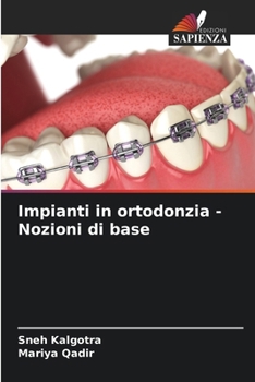 Paperback Impianti in ortodonzia - Nozioni di base [Italian] Book