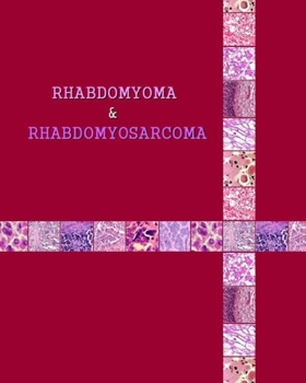 Paperback Rhabdomyoma & Rhabdomyosarcoma Book