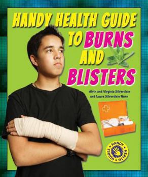 Library Binding Handy Health Guide to Burns and Blisters Book