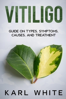 Paperback Vitiligo: Guide on Types, Symptoms, Causes, and Treatment Book