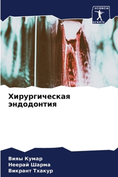Paperback Хирургическая эндодонт&# [Russian] Book